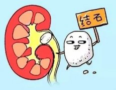小石頭大麻煩，難道只能一碎了之？中醫(yī)專家李琦告訴你腎結(jié)石得這